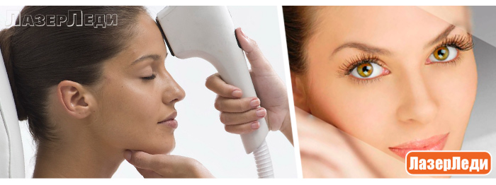 фотоомоложение, лазерное омоложение кожи, laser facial rejuvenation, beauty, лифтинг кожи, радиоволновой лифтинг, лазерледи, ультразвуковой пилинг, контурная коррекция